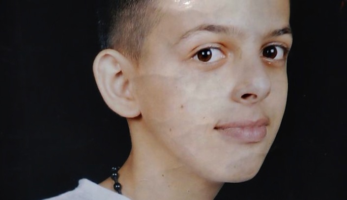 Il sedicenne arabo-israeliano Muhammad Abu Khdeir rapito e arso vivo da tre ragazzi israeliani il giorno dopo la pubblicazione del post di Shaked.
