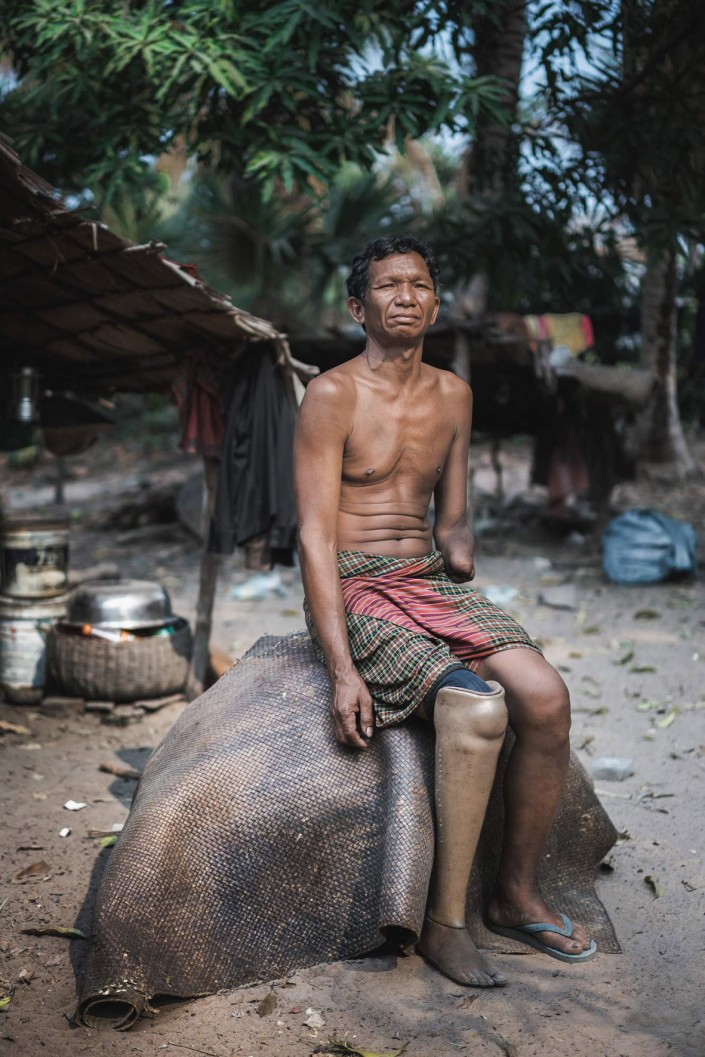 Portrait of a victim of mines and Khmer Rouge. ©-Simon-Guillemin_-Festival-della-Fotografia-Etica